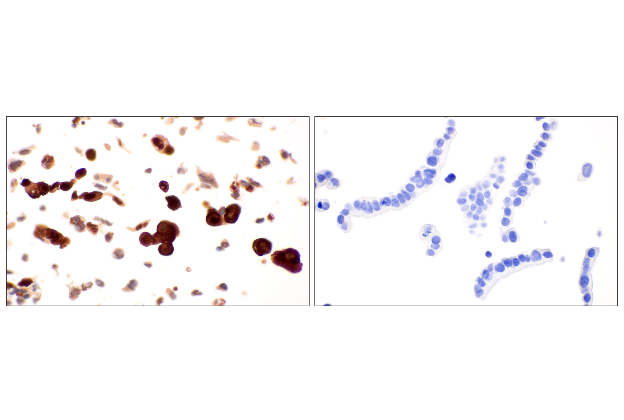 Immunohistochemistry Image 12: MTAP (E5R1I) Rabbit mAb (BSA and Azide Free)