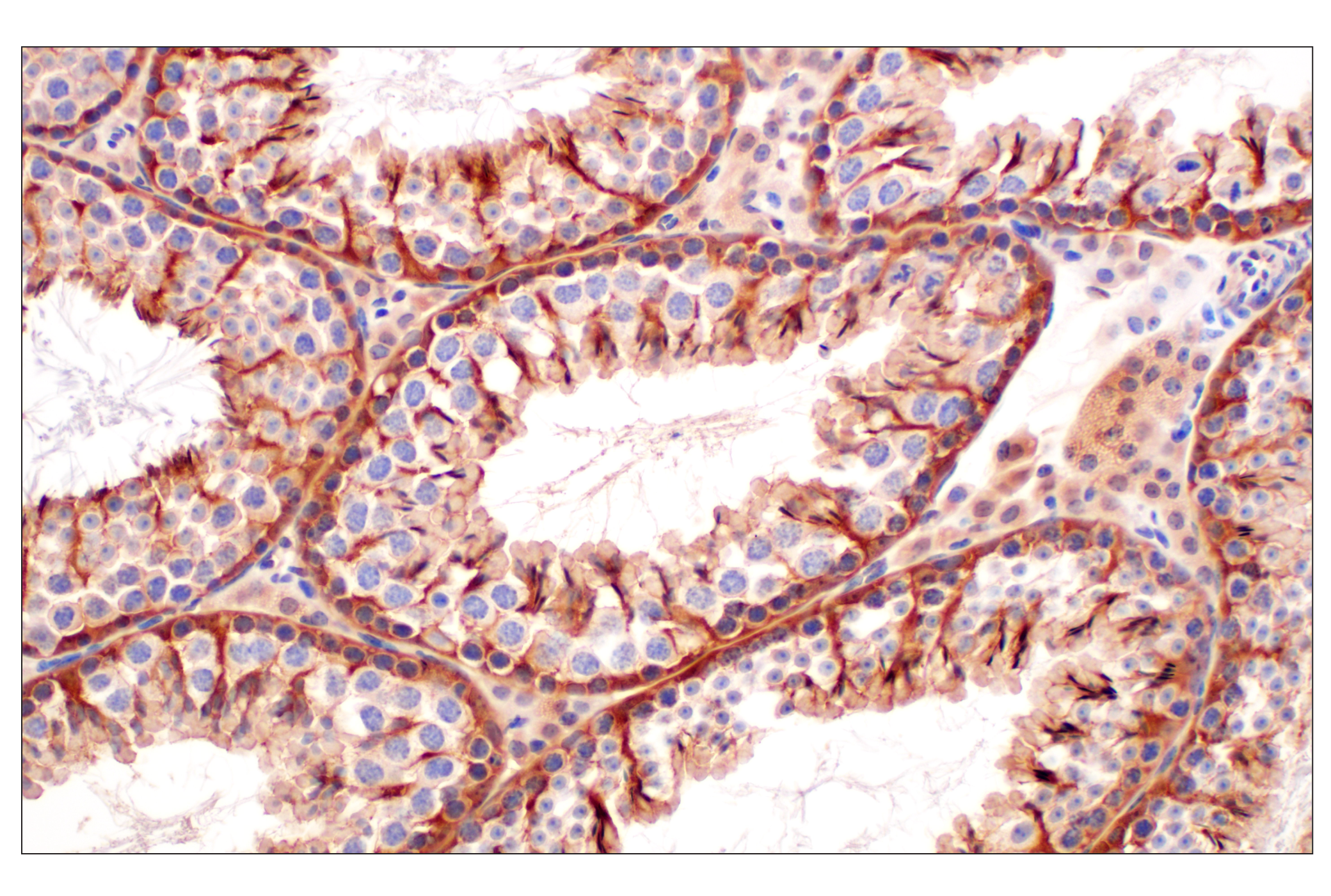 Immunohistochemistry Image 9: MTAP (E5R1I) Rabbit mAb (BSA and Azide Free)