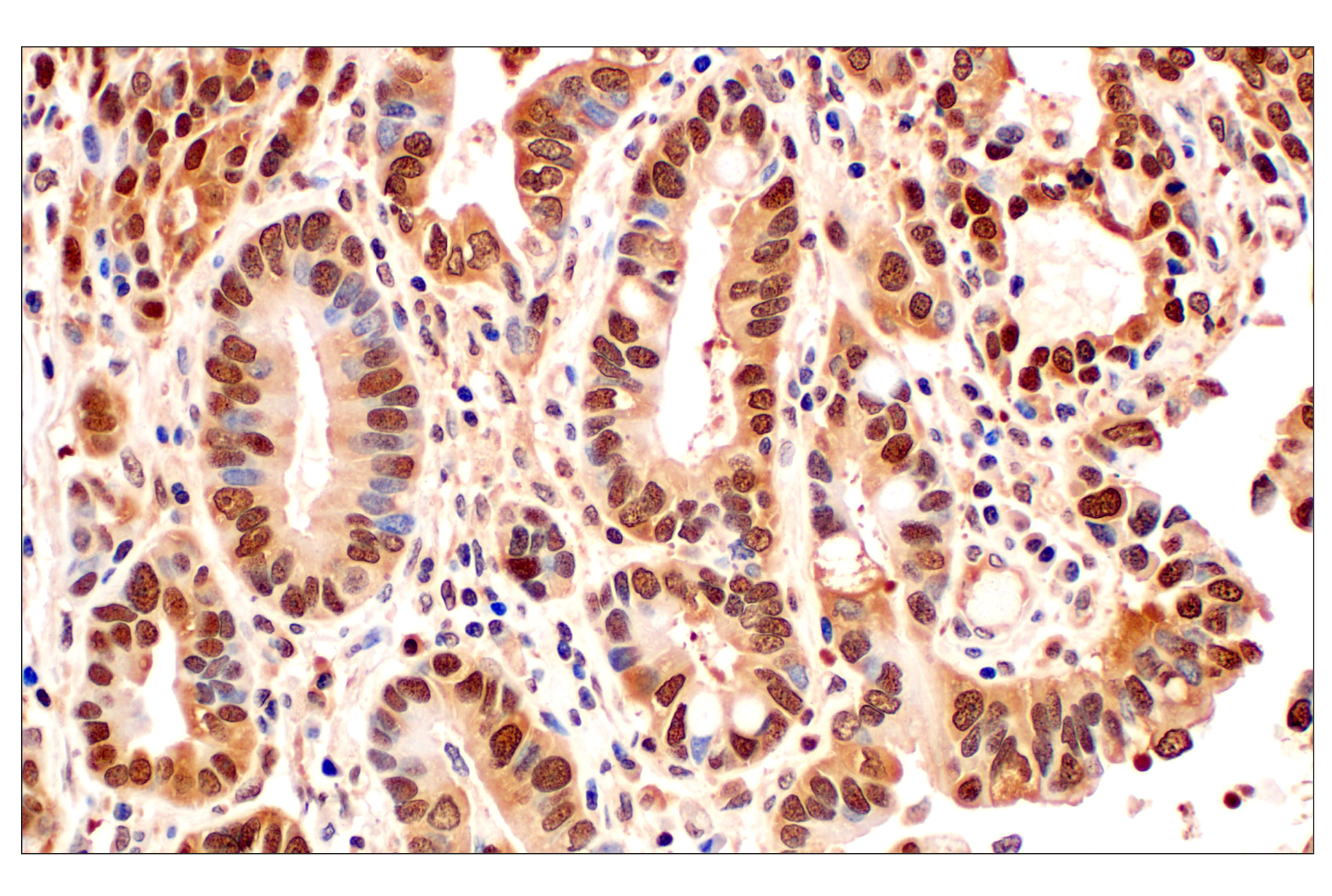 Immunohistochemistry Image 1: MTAP (E5R1I) Rabbit mAb (BSA and Azide Free)