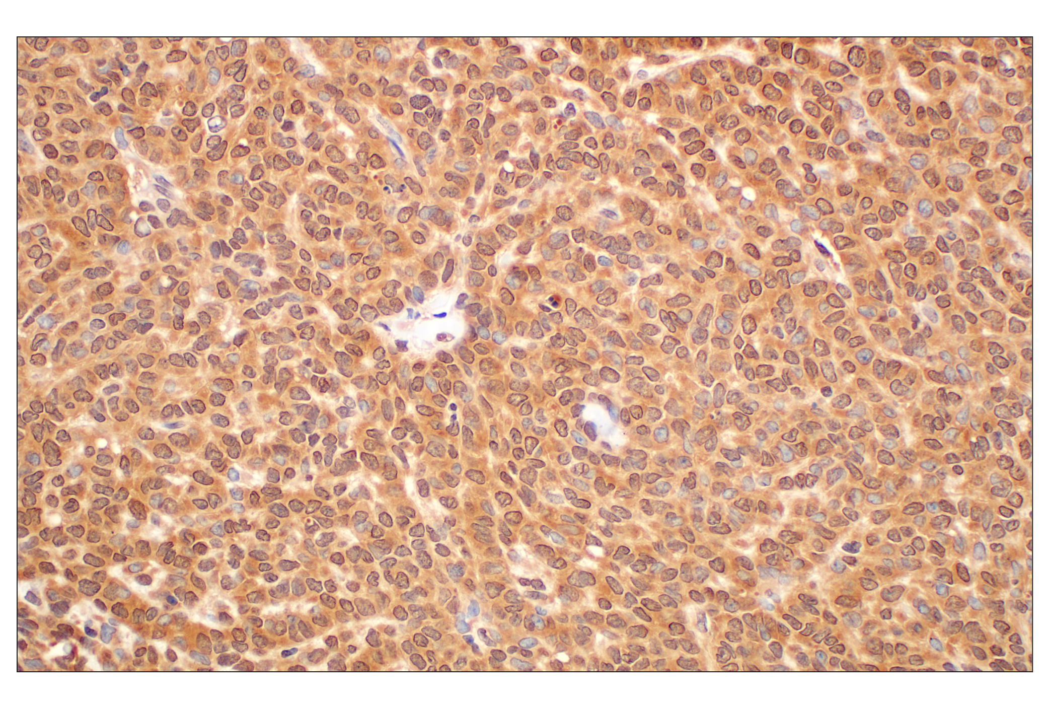 Immunohistochemistry Image 3: MTAP (E5R1I) Rabbit mAb (BSA and Azide Free)