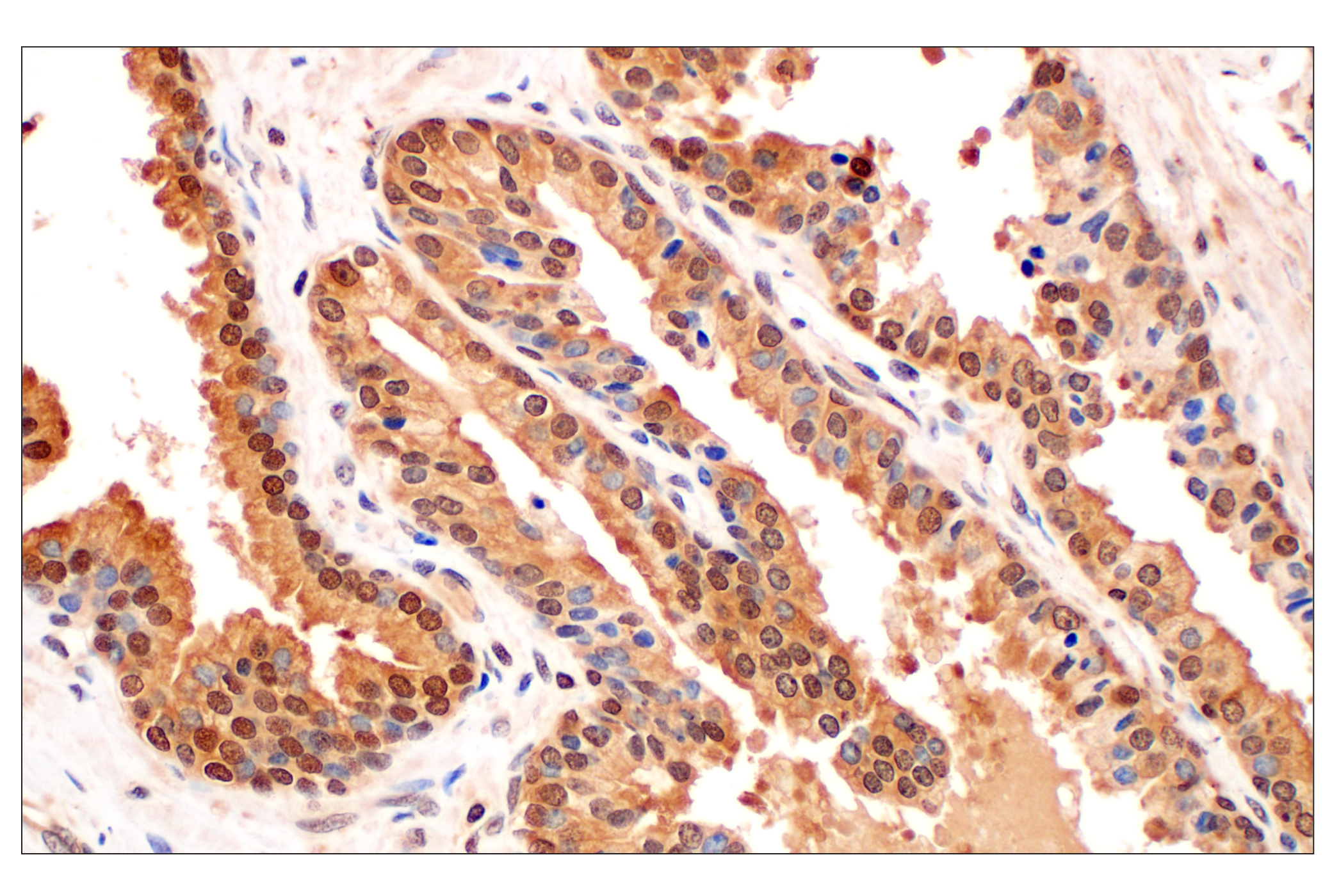 Immunohistochemistry Image 2: MTAP (E5R1I) Rabbit mAb (BSA and Azide Free)