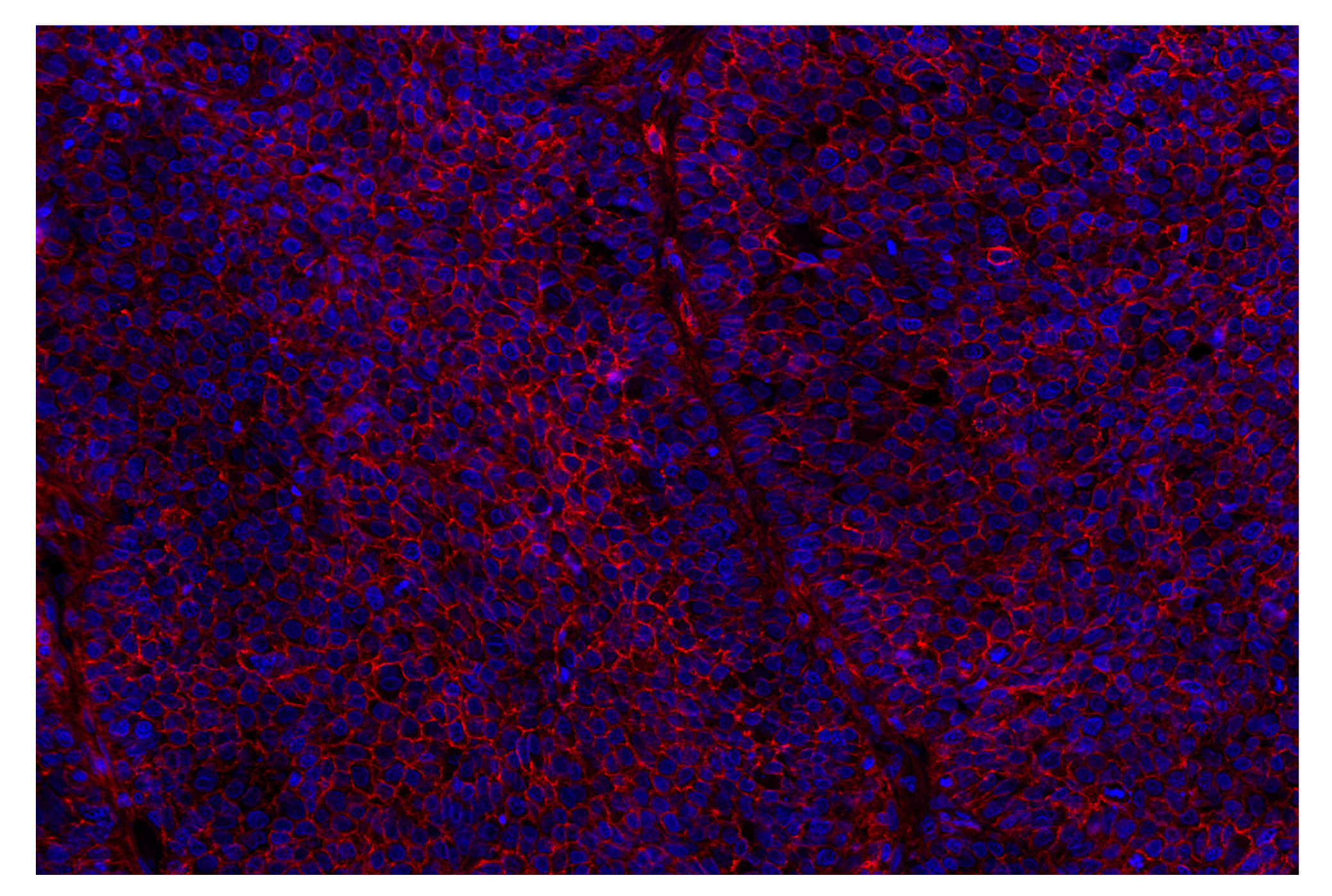 Immunohistochemistry Image 2: CD44 (E7K2Y) XP® Rabbit mAb (Alexa Fluor® 555 Conjugate)