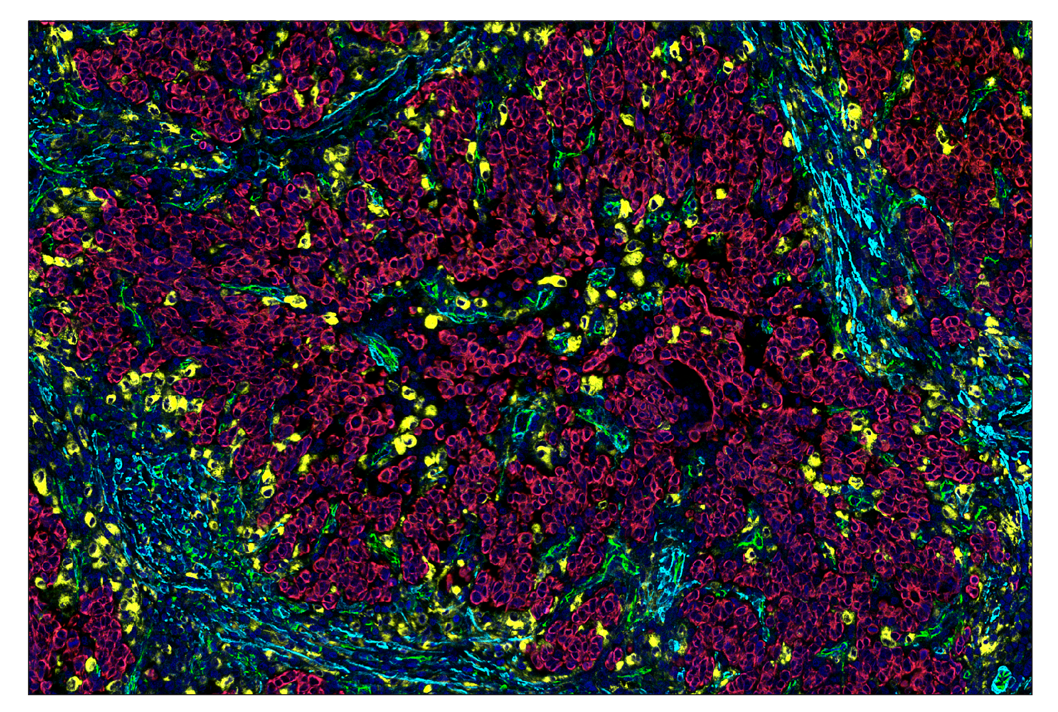 Immunohistochemistry Image 7: CD31 (PECAM-1) (89C2) & CO-0028-594 SignalStar™ Oligo-Antibody Pair