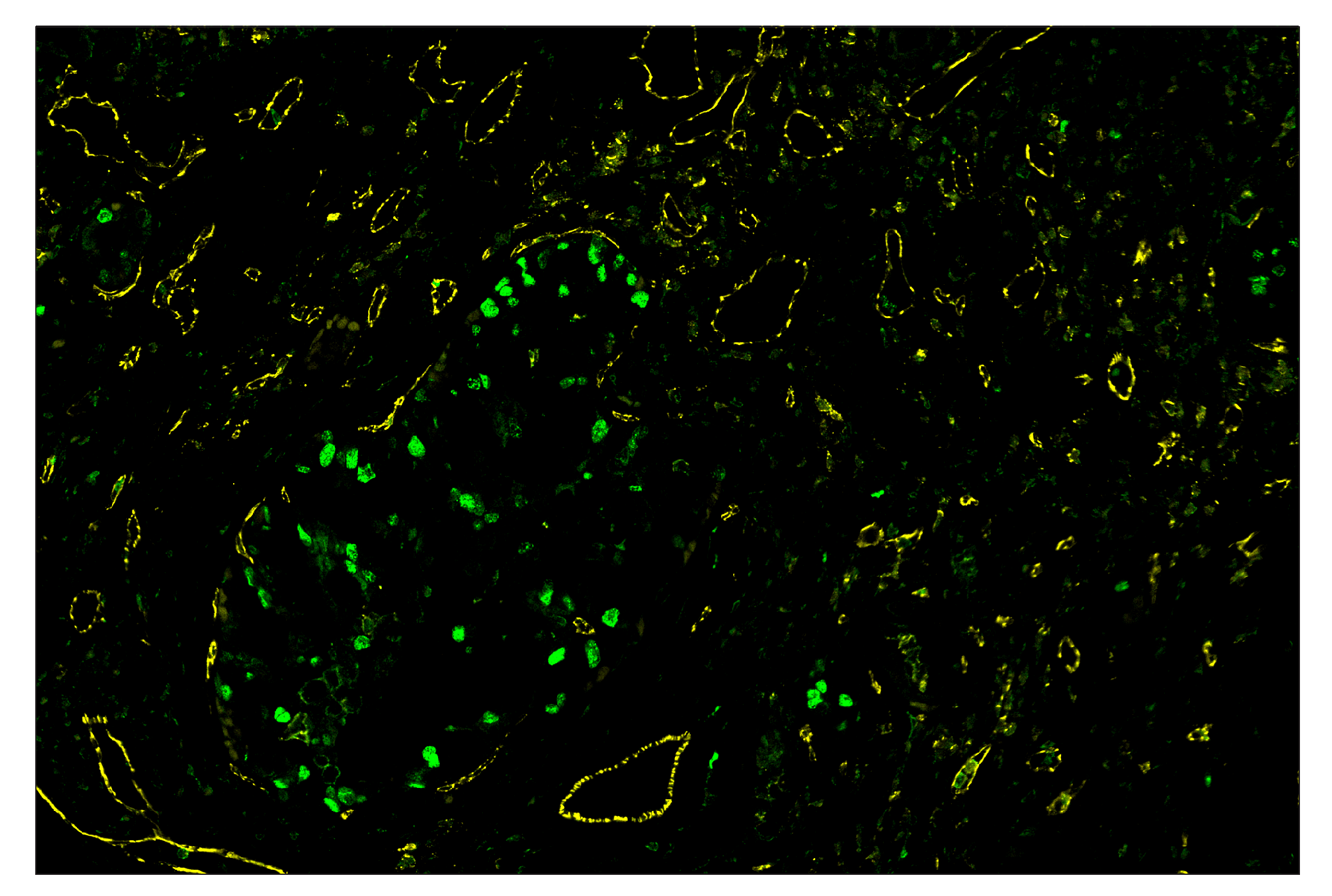 Immunohistochemistry Image 8: CD31 (PECAM-1) (89C2) & CO-0028-488 SignalStar™ Oligo-Antibody Pair