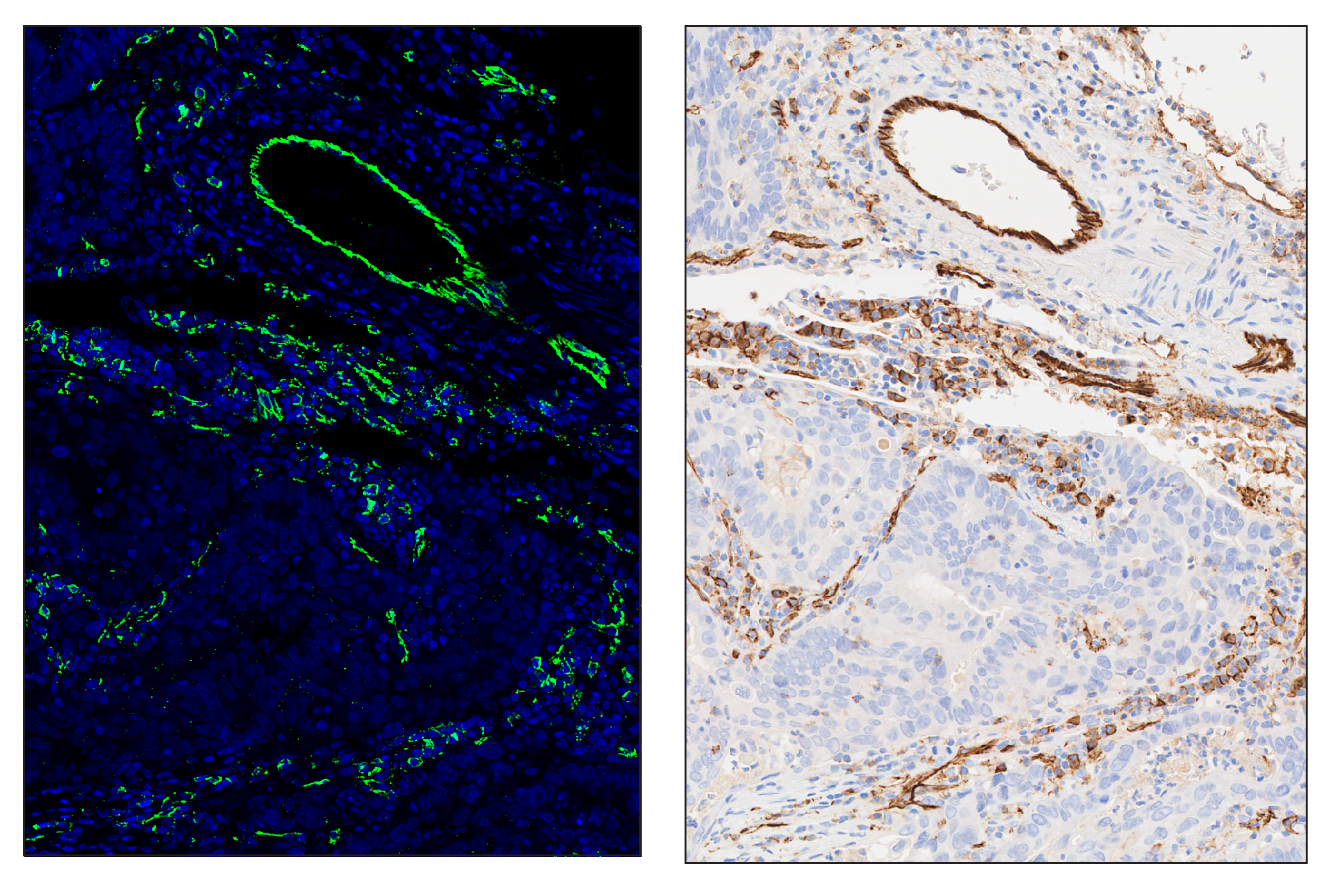 Immunohistochemistry Image 6: CD31 (PECAM-1) (89C2) & CO-0028-594 SignalStar™ Oligo-Antibody Pair