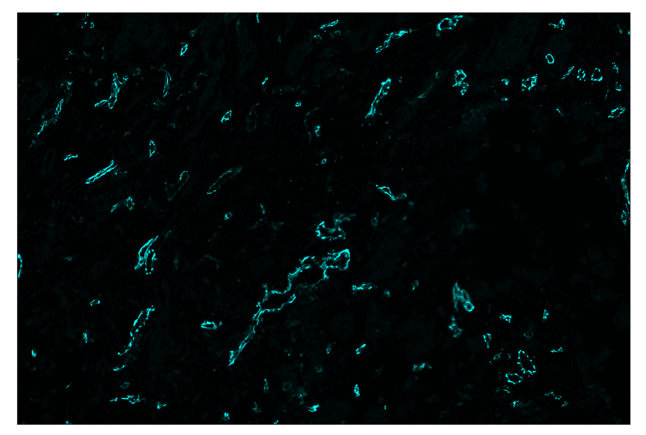 Immunohistochemistry Image 5: CD31 (PECAM-1) (89C2) & CO-0028-750 SignalStar™ Oligo-Antibody Pair
