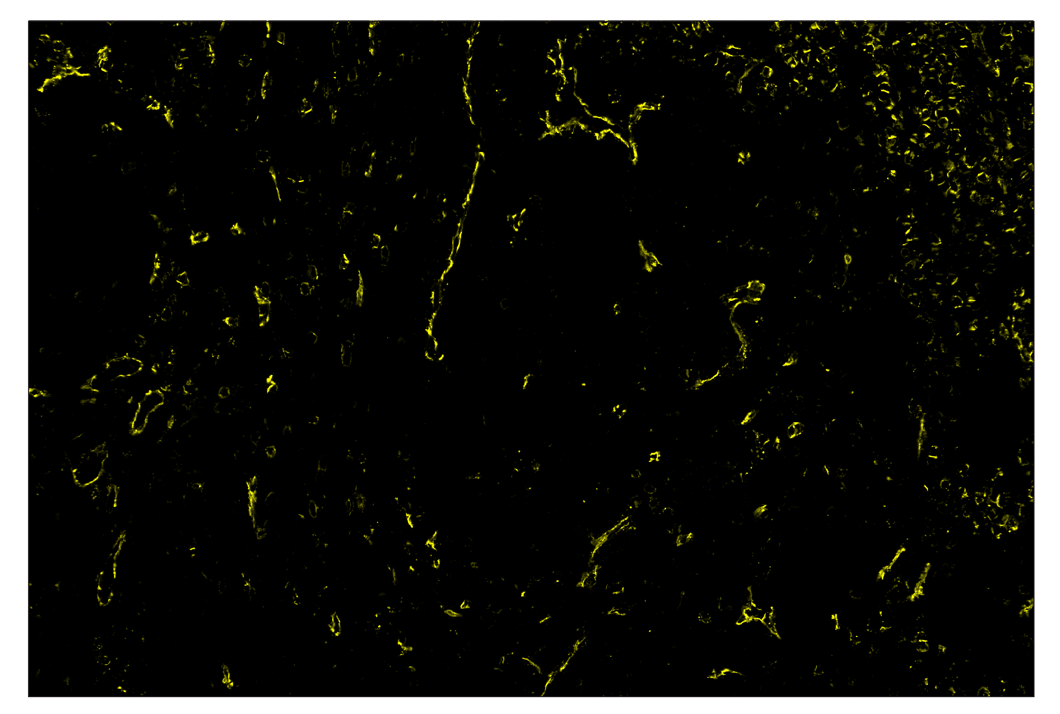 Immunohistochemistry Image 3: CD31 (PECAM-1) (89C2) & CO-0028-594 SignalStar™ Oligo-Antibody Pair