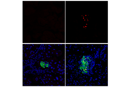 Immunofluorescence Image 1: Cre Recombinase (D7L7L) XP® Rabbit mAb (Alexa Fluor® 647 Conjugate)