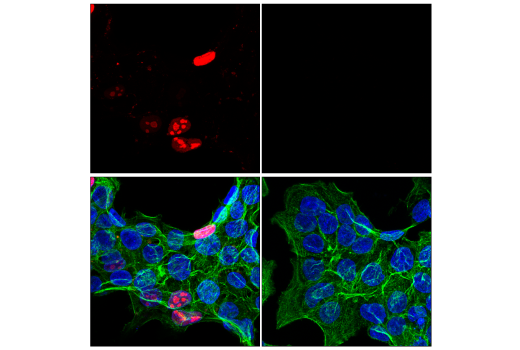 Immunofluorescence Image 2: Cre Recombinase (D7L7L) XP® Rabbit mAb (Alexa Fluor® 647 Conjugate)