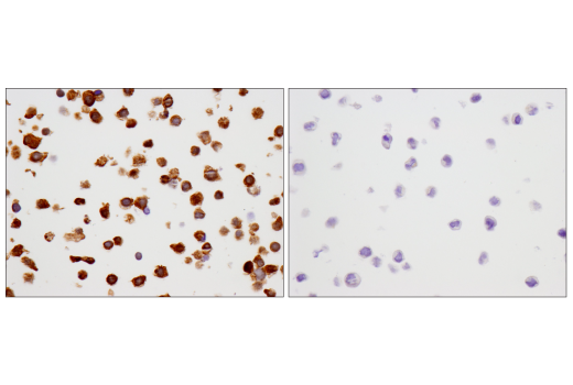 Immunohistochemistry Image 5: SMAD4 (D3R4N) XP® Rabbit mAb (BSA and Azide Free)