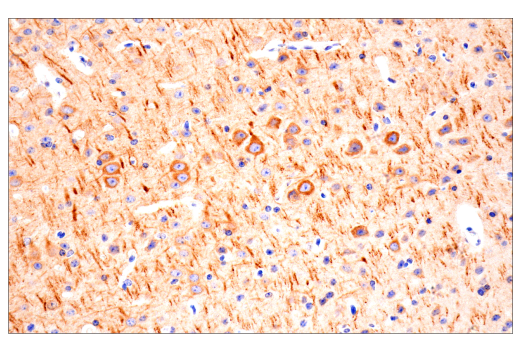 Immunohistochemistry Image 9: CTHRC1 (E8M9S) Rabbit mAb
