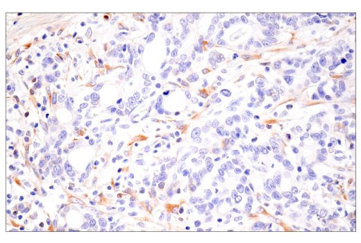 Immunohistochemistry Image 4: CTHRC1 (E8M9S) Rabbit mAb