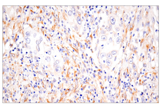 Immunohistochemistry Image 2: CTHRC1 (E8M9S) Rabbit mAb