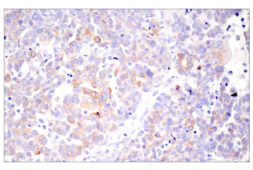 Immunohistochemistry Image 6: CTHRC1 (E8M9S) Rabbit mAb