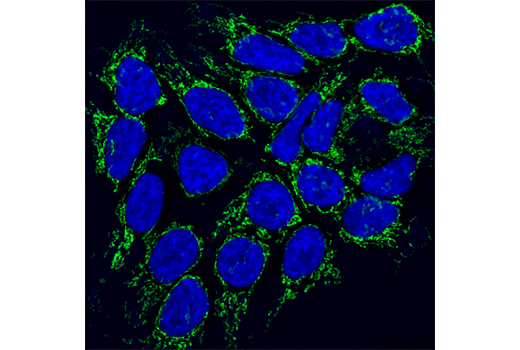 Immunofluorescence Image 1: SLP-2 (D5N4E) Rabbit mAb