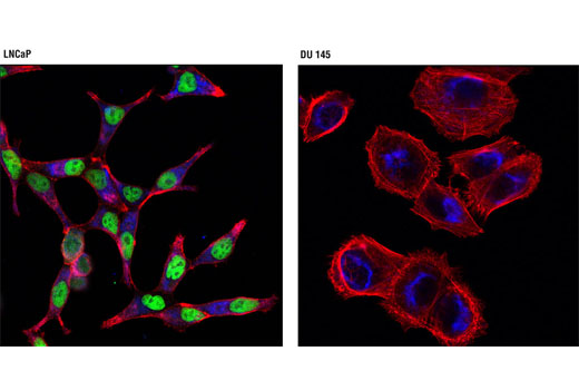 Immunofluorescence Image 1: Androgen Receptor (D6F11) XP® Rabbit mAb (Alexa Fluor® 488 Conjugate)