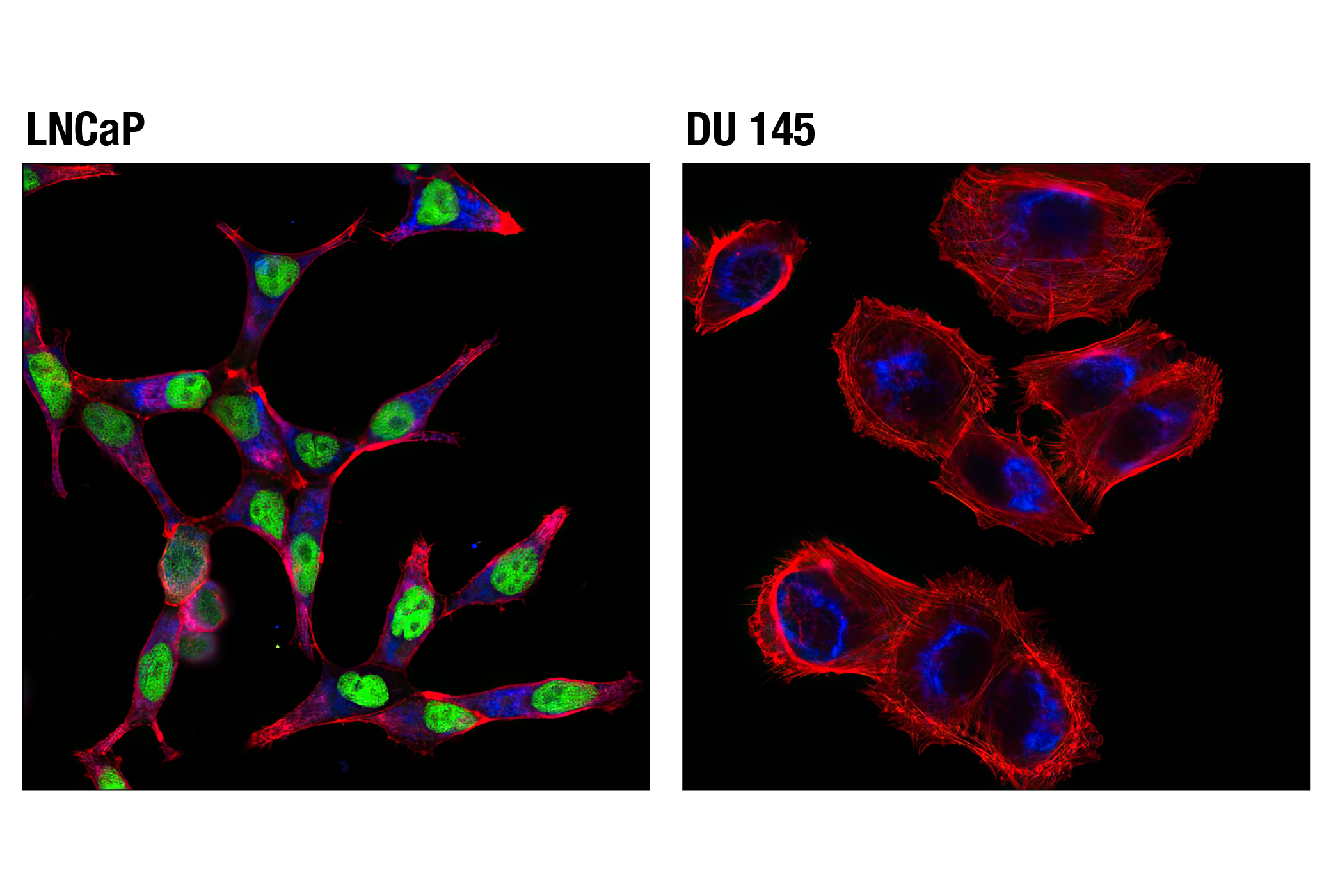 Immunofluorescence Image 1: Androgen Receptor (D6F11) XP® Rabbit mAb (Alexa Fluor® 488 Conjugate)