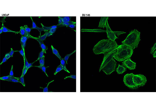 Immunofluorescence Image 1: Androgen Receptor (D6F11) XP® Rabbit mAb (Alexa Fluor® 647 Conjugate)