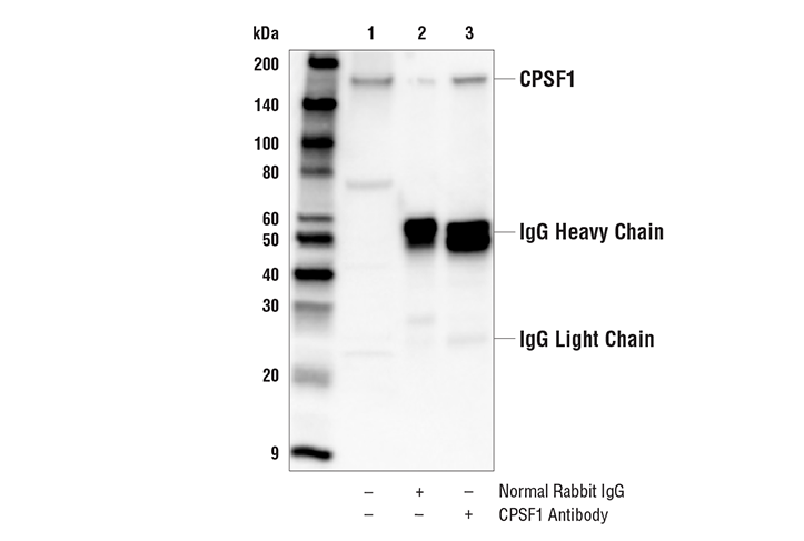Immunoprecipitation Image 1: CPSF1 Antibody