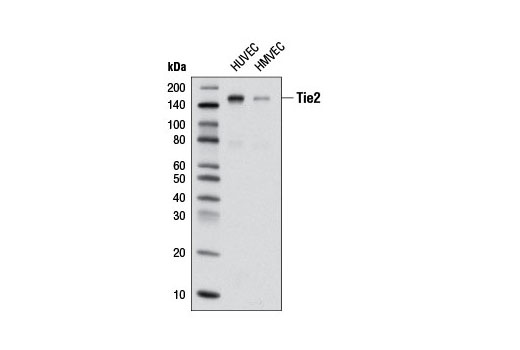  Image 13: Angiogenesis Receptor Tyrosine Kinase Antibody Sampler Kit