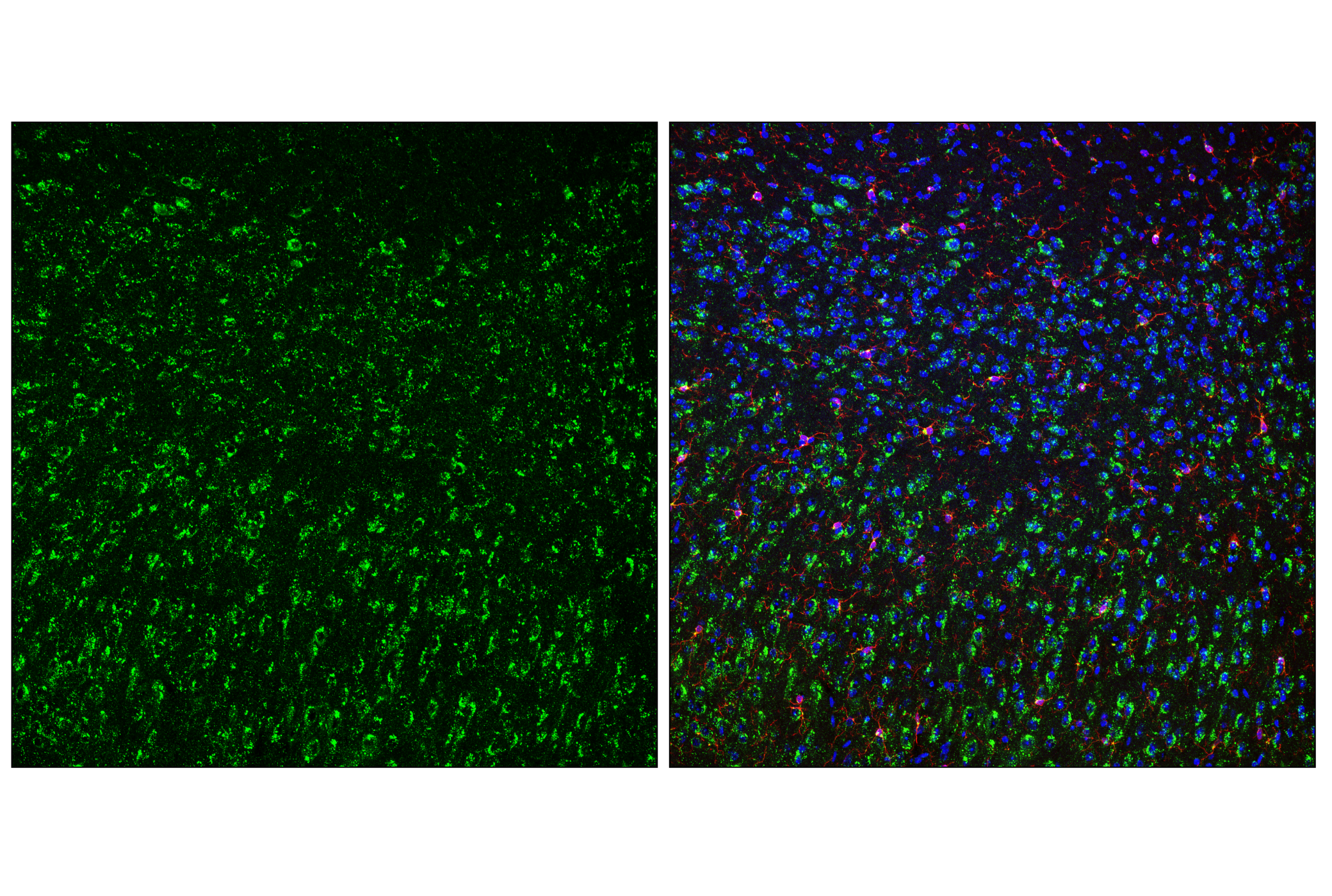 Immunofluorescence Image 2: Cathepsin D (E5V4H) Rabbit mAb