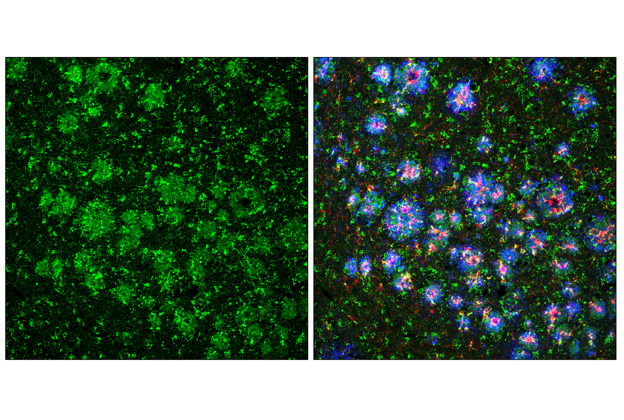 Immunofluorescence Image 1: Cathepsin D (E5V4H) Rabbit mAb