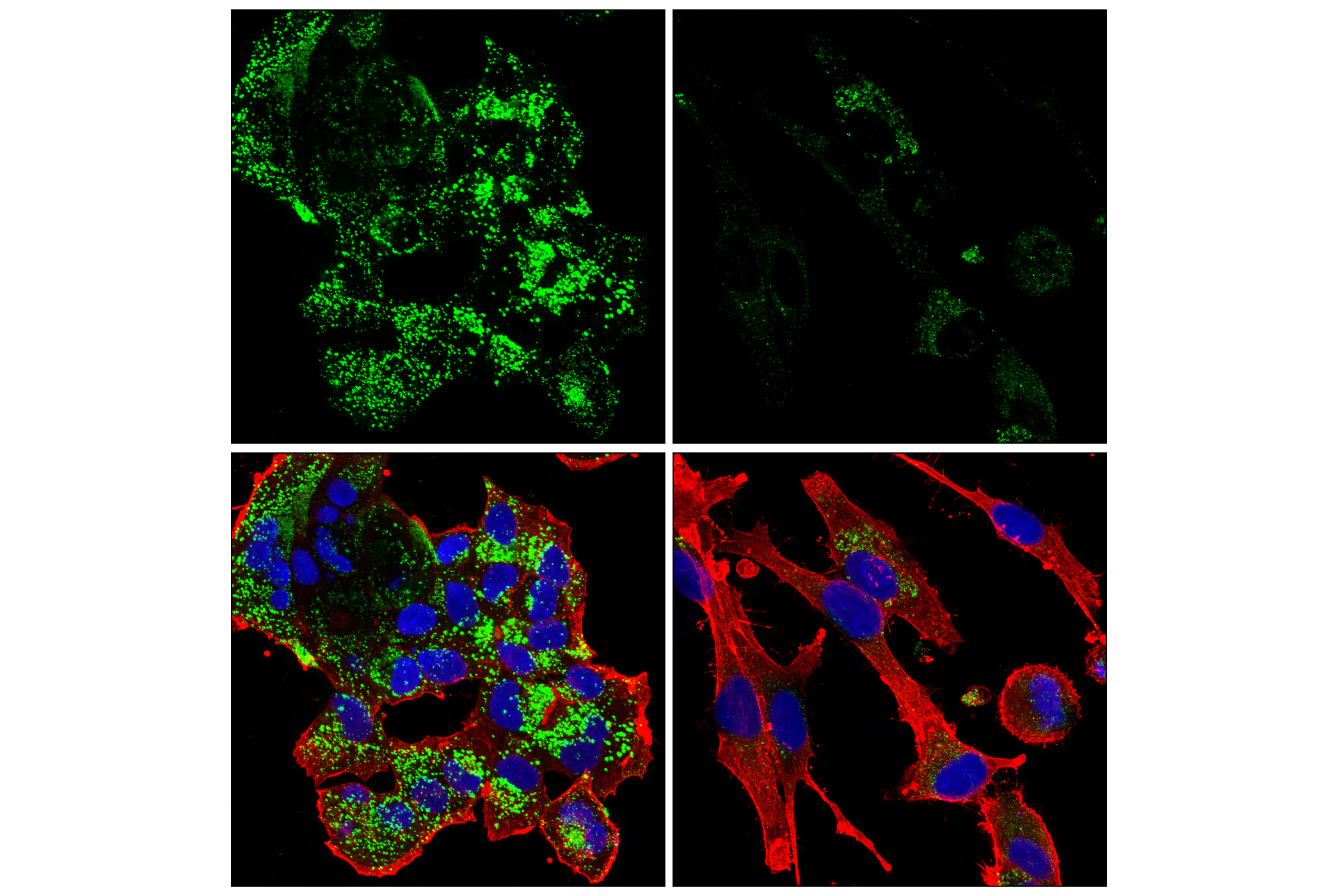 Immunofluorescence Image 5: Cathepsin D (E5V4H) Rabbit mAb