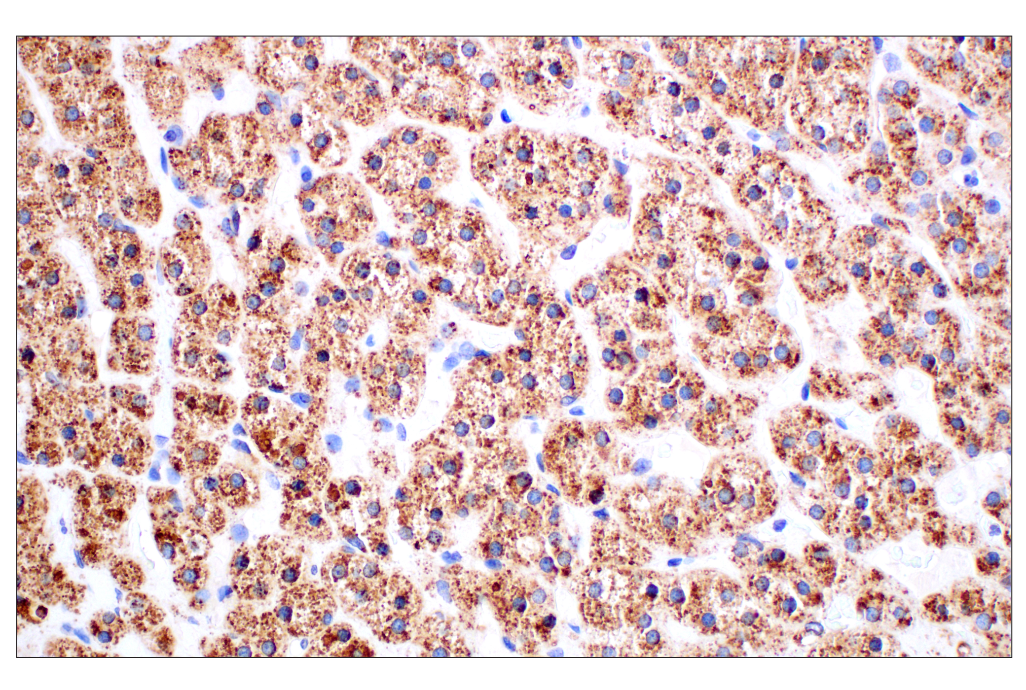 Immunohistochemistry Image 4: Cathepsin D (E5V4H) Rabbit mAb