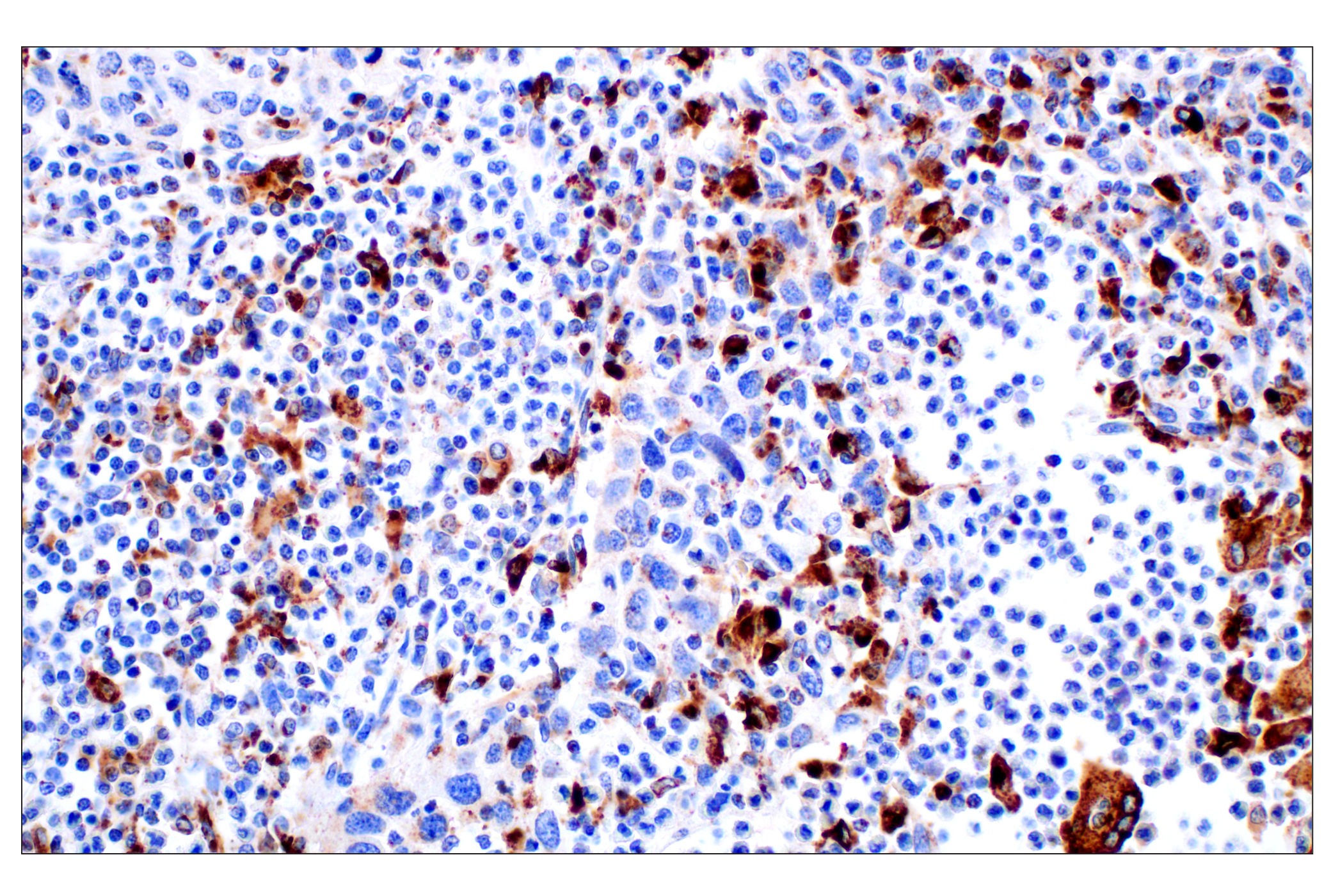 Immunohistochemistry Image 1: Cathepsin D (E5V4H) Rabbit mAb