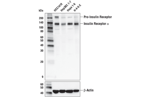 Western Blotting Image 1: Insulin Receptor α (D3U7I) Rabbit mAb
