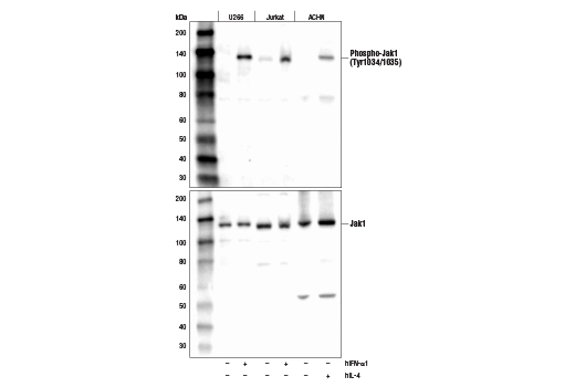  Image 11: IFN (Type I/III) Signaling Pathway Antibody Sampler Kit