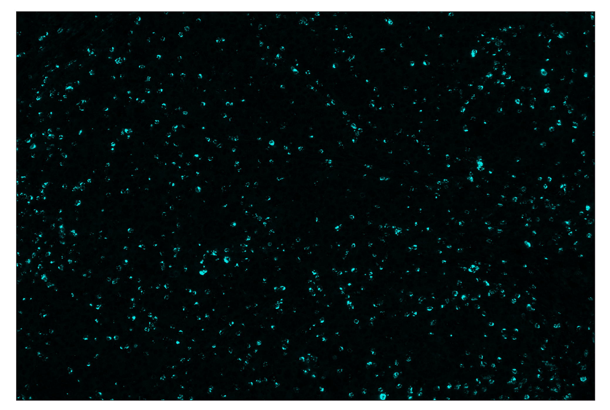 Immunohistochemistry Image 5: Granzyme B (D6E9W) & CO-0009-594 SignalStar™ Oligo-Antibody Pair