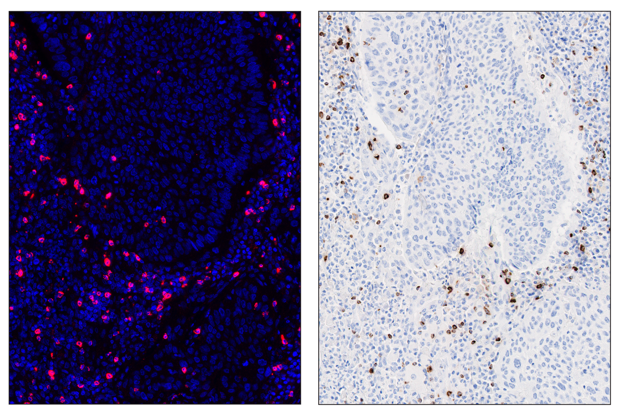 Immunohistochemistry Image 6: Granzyme B (D6E9W) & CO-0009-647 SignalStar™ Oligo-Antibody Pair
