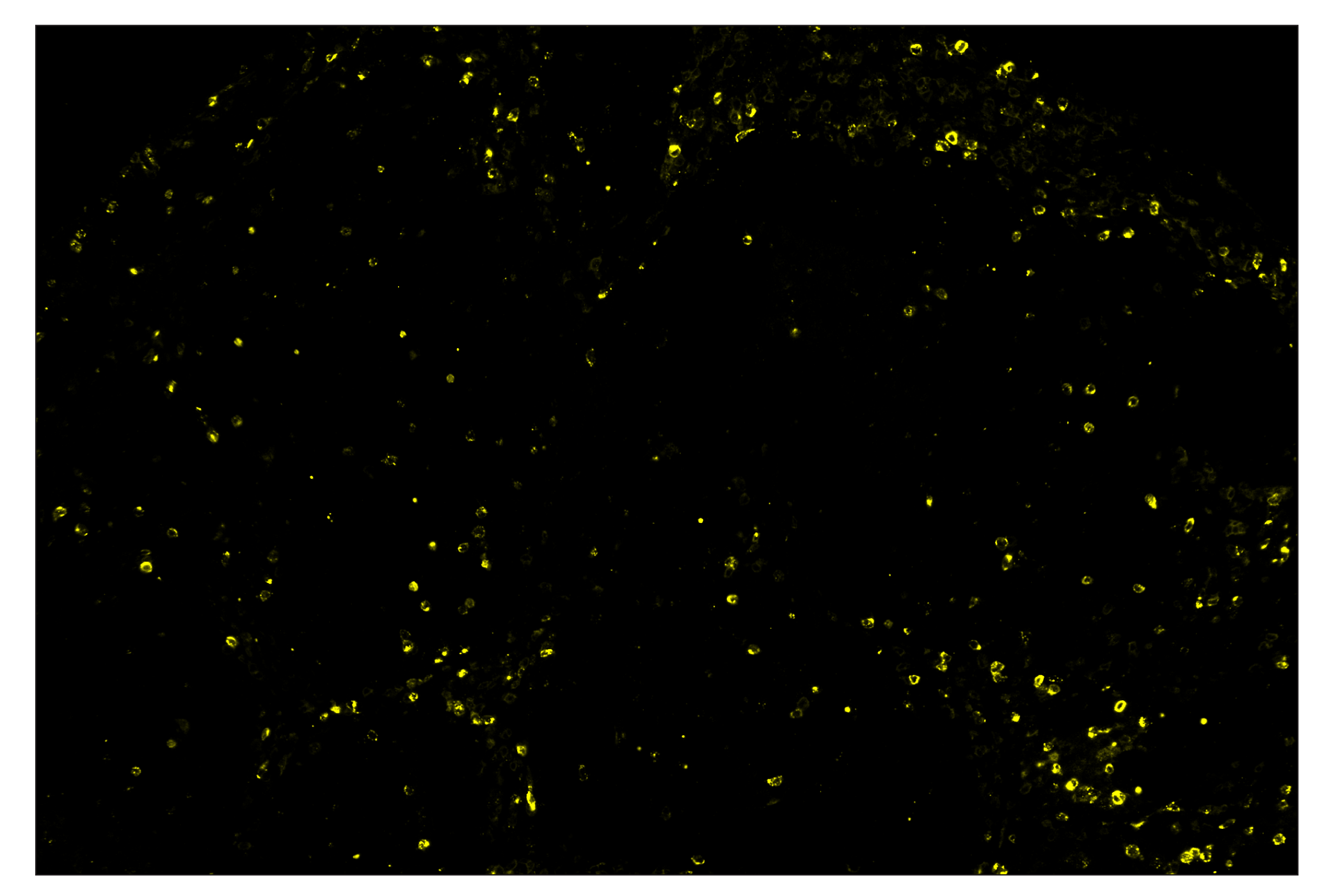 Immunohistochemistry Image 3: Granzyme B (D6E9W) & CO-0009-750 SignalStar™ Oligo-Antibody Pair