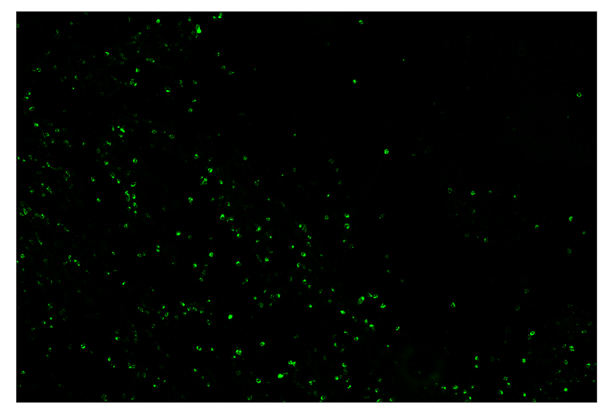 Immunohistochemistry Image 2: Granzyme B (D6E9W) & CO-0009-647 SignalStar™ Oligo-Antibody Pair