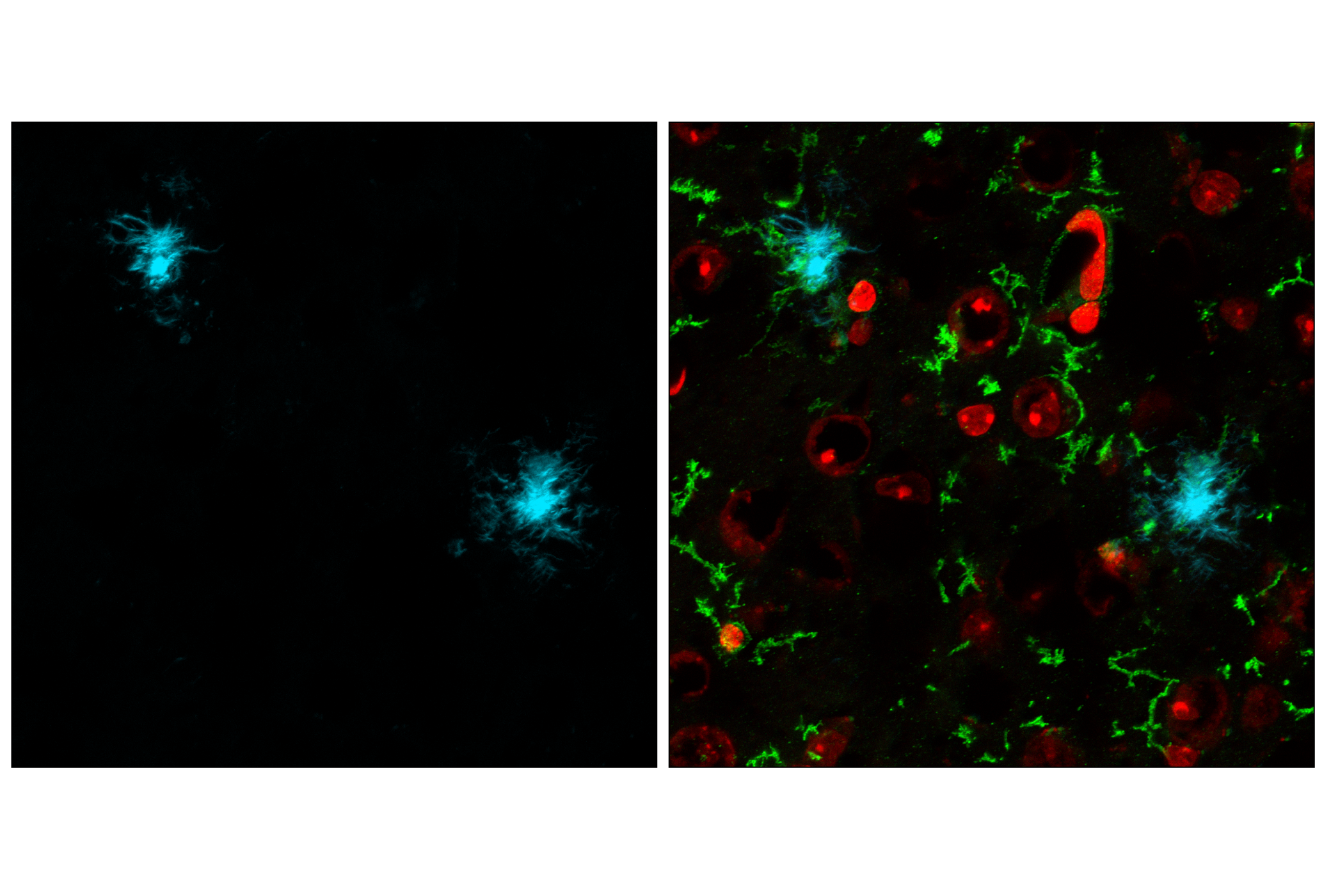 Immunofluorescence Image 1: X-34