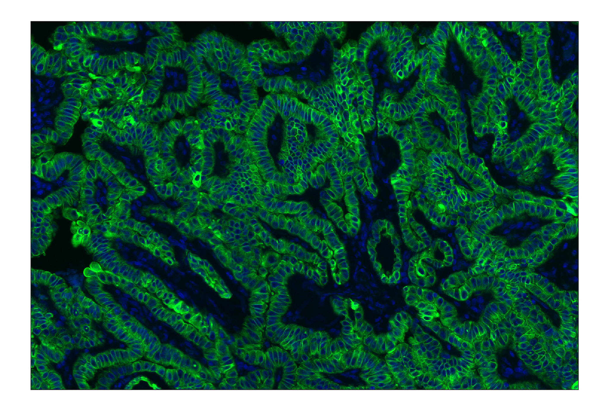 Immunohistochemistry Image 2: Pan-Keratin (Type I) (E6S1S) Rabbit mAb (Alexa Fluor® 488 Conjugate)