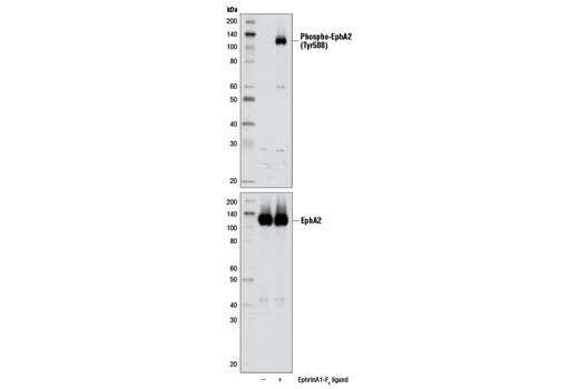 Western Blotting Image 1: Phospho-EphA2 (Tyr588) Antibody