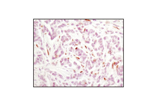 Immunohistochemistry Image 2: Phospho-Stat3 (Tyr705) (M9C6) Mouse mAb (BSA and Azide Free)