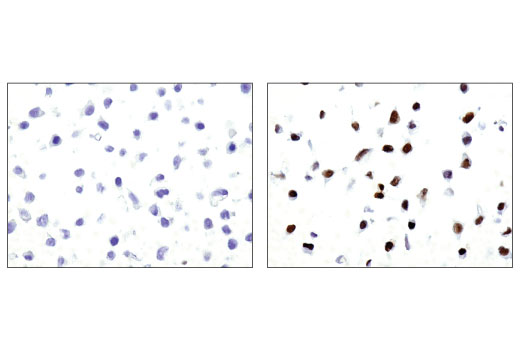 Immunohistochemistry Image 1: Phospho-Stat3 (Tyr705) (M9C6) Mouse mAb (BSA and Azide Free)