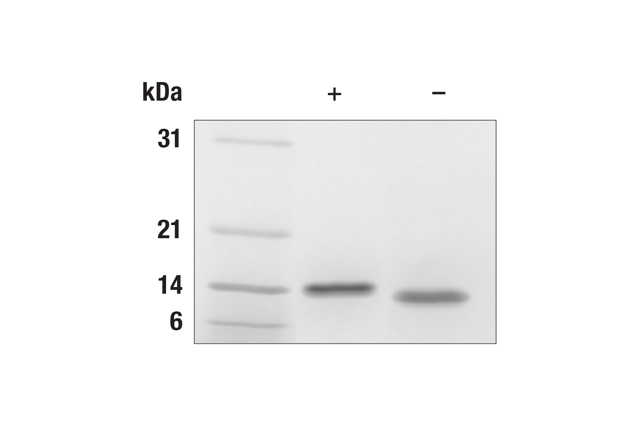  Image 2: Human IL-4 Recombinant Protein
