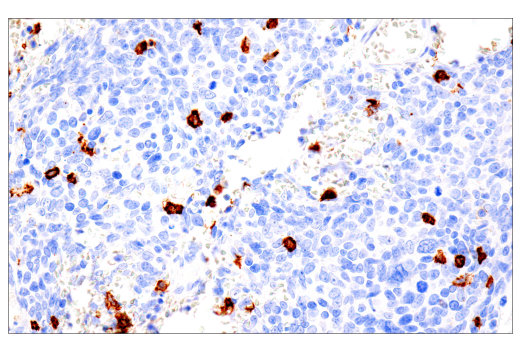 Immunohistochemistry Image 2: CD20 (L26) Mouse mAb