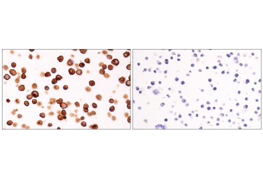 Immunohistochemistry Image 6: CD20 (L26) Mouse mAb