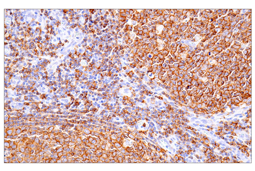 Immunohistochemistry Image 7: CD20 (L26) Mouse mAb