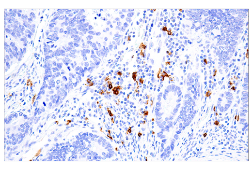 Immunohistochemistry Image 8: CD20 (L26) Mouse mAb