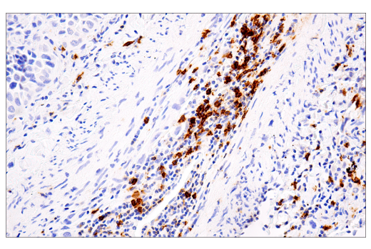 Immunohistochemistry Image 9: CD20 (L26) Mouse mAb
