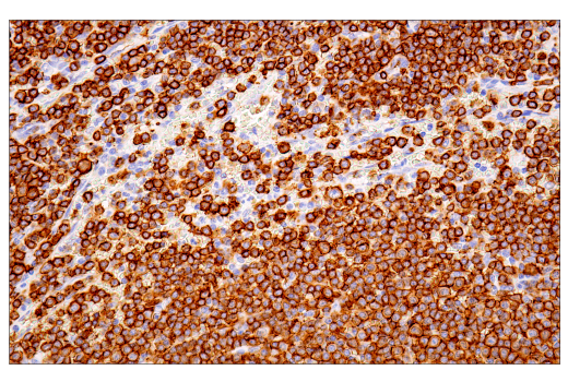 Immunohistochemistry Image 10: CD20 (L26) Mouse mAb