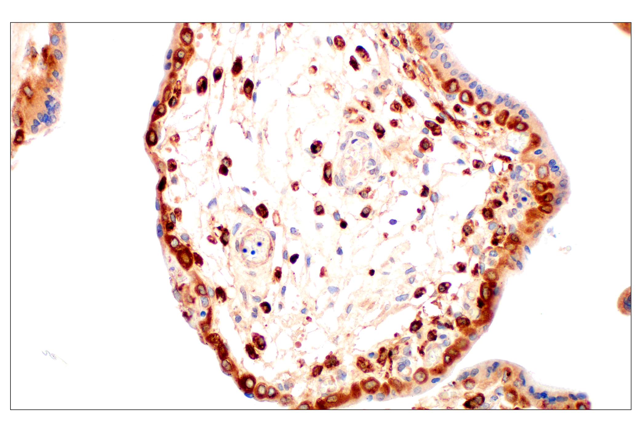 Immunohistochemistry Image 13: Cathepsin L (E3R3P) Rabbit mAb (BSA and Azide Free)