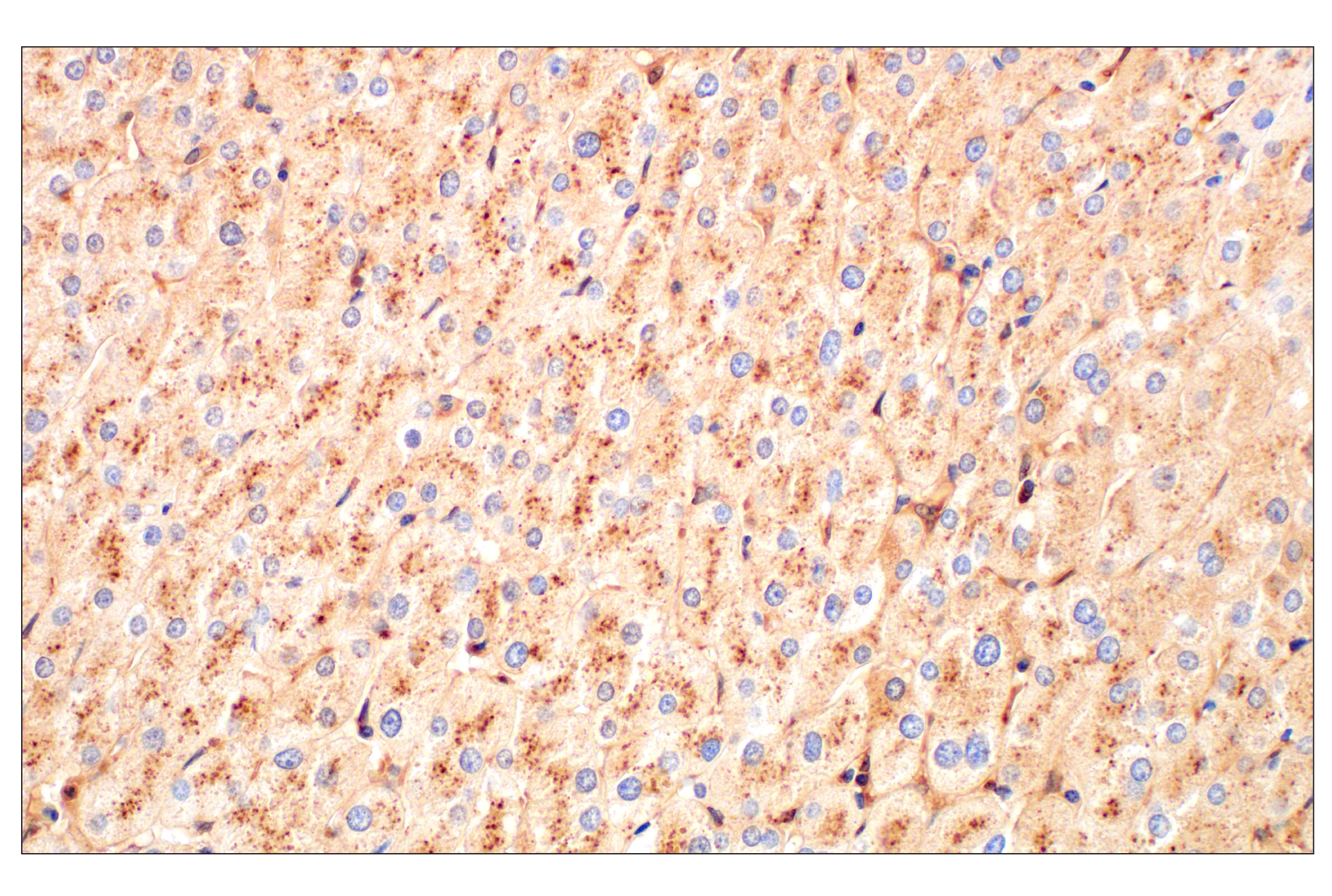 Immunohistochemistry Image 9: Cathepsin L (E3R3P) Rabbit mAb (BSA and Azide Free)