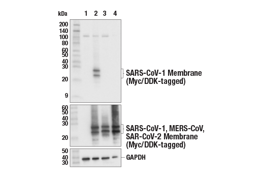 Western Blotting Image 1: SARS-CoV-1 Membrane Protein Antibody